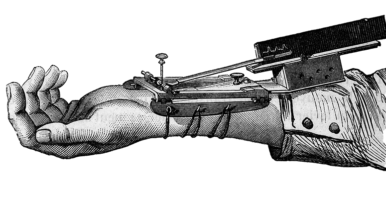 Woodblock illustration of Marey blood pressure measurement instrument